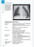 Штаатц Honnef Пірот Променева діагностика. Дитячі хвороби, фото 6