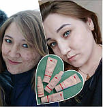 Комплекс "Проти прищів - SOS дія" Джерелія, фото 2