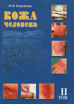Ю.В. Кішевенко "Шкіра людини" другий том. Варіанти патогенного впливу на структуру та функції шкіри...