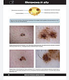 Боулінг Джонатан Діагностична дерматоскопія. Ілюстроване керівництво, фото 8