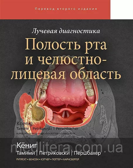 Кеніг Променева діагностика Порожнину рота і щелепно-лицьова область 2021 рік