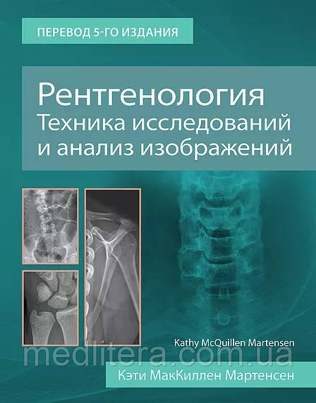 Мартенс Рентгенологія Техніка досліджень та аналіз зображень 2021 рік