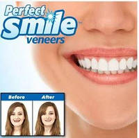 Вініри каппи для зубів Perfect Smile Veneers