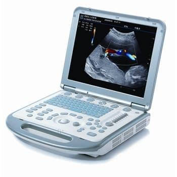 Портативні УЗД