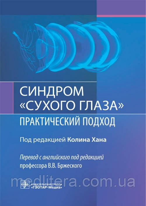 Хана Під ред. Ст. Ст. Бржеского Синдром "сухого ока": практичний підхід 2021 рік