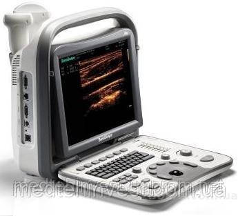 Апарат УЗІ SonoScape A6, фото 1