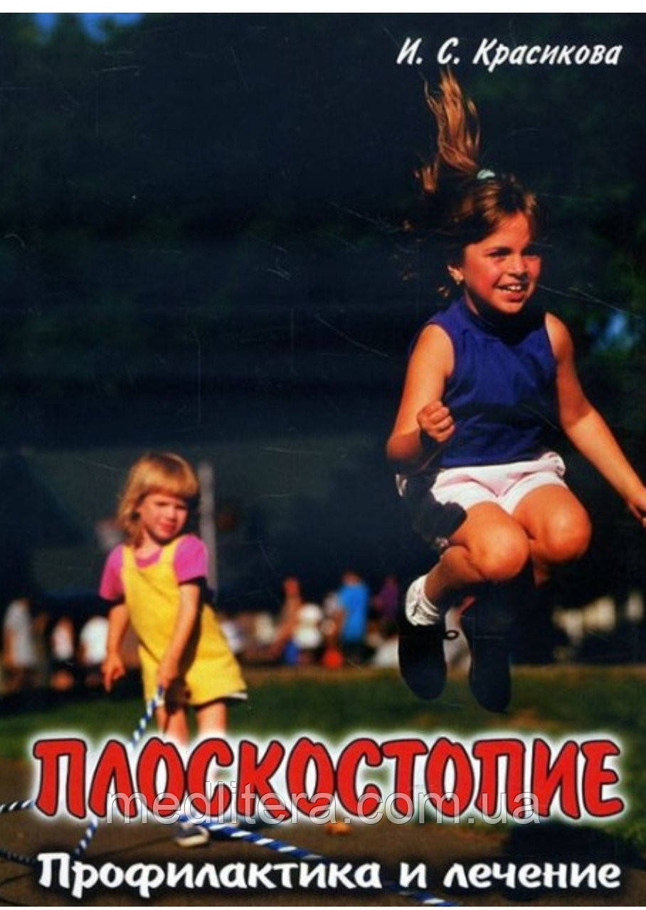 Плоскостопість. Профілактика і лікування - Ірина Красикова 978-5-7931-0949-9