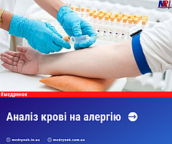 Аналіз крові на алергію