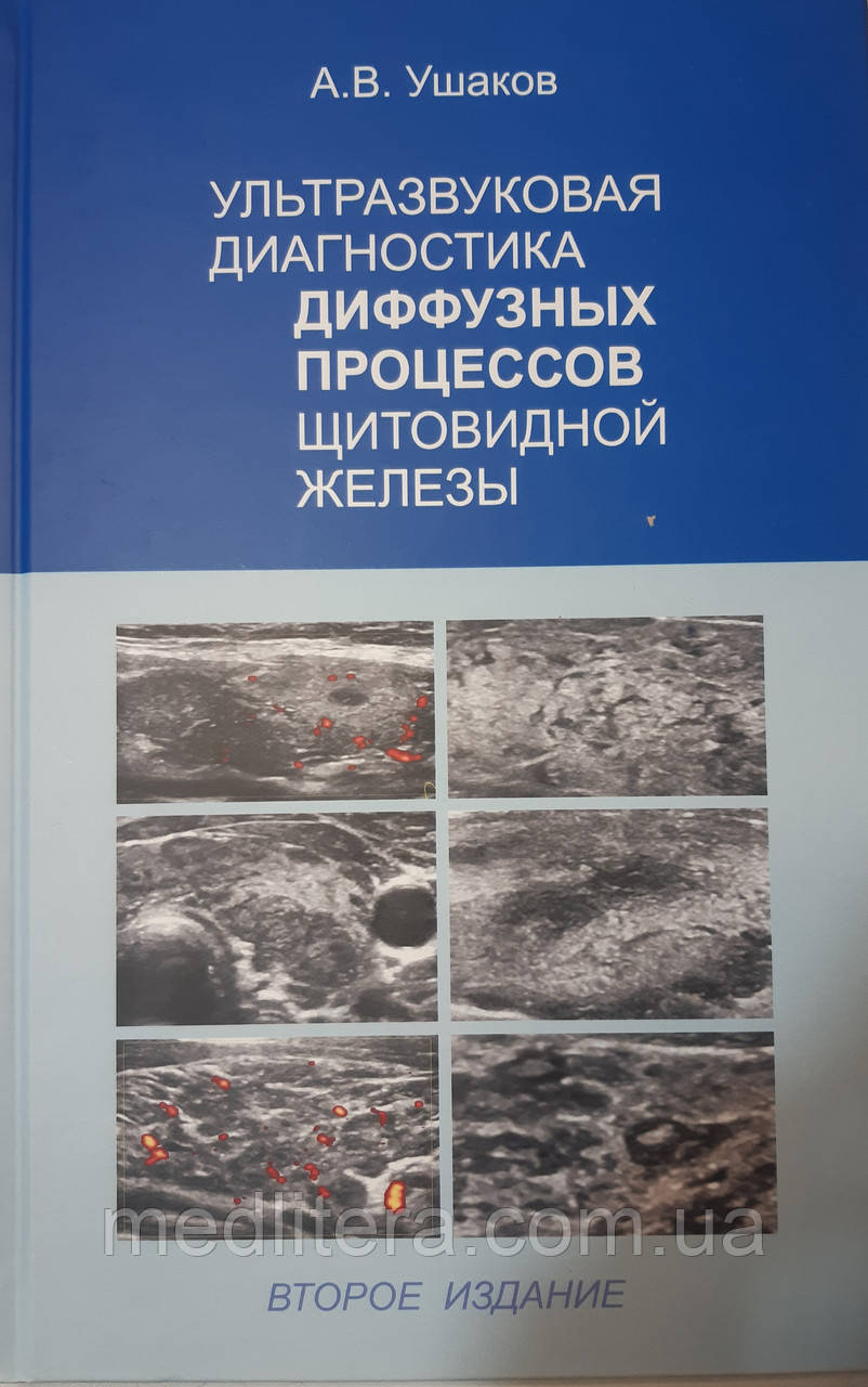 Ушаков. Ультразвукова діагностика дифузних процесів щитовидної залози 2-е изд. 2020 р.