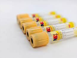 Пробірка вакуумна для забору крові та з роздільним гелем MEDRYNOK, 3,5 мл, з активатором зсідання, 13х75 жовта кришка