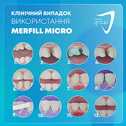 Клінічний випадок використання MerFill MICRO