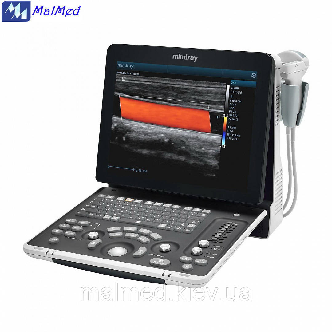 Mindray Z60 (з 2 датчиками) портативний ультразвуковий апарат