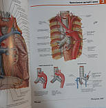 Неттер Атлас анатомии человека (4-е видання) тверда палітурка, фото 2