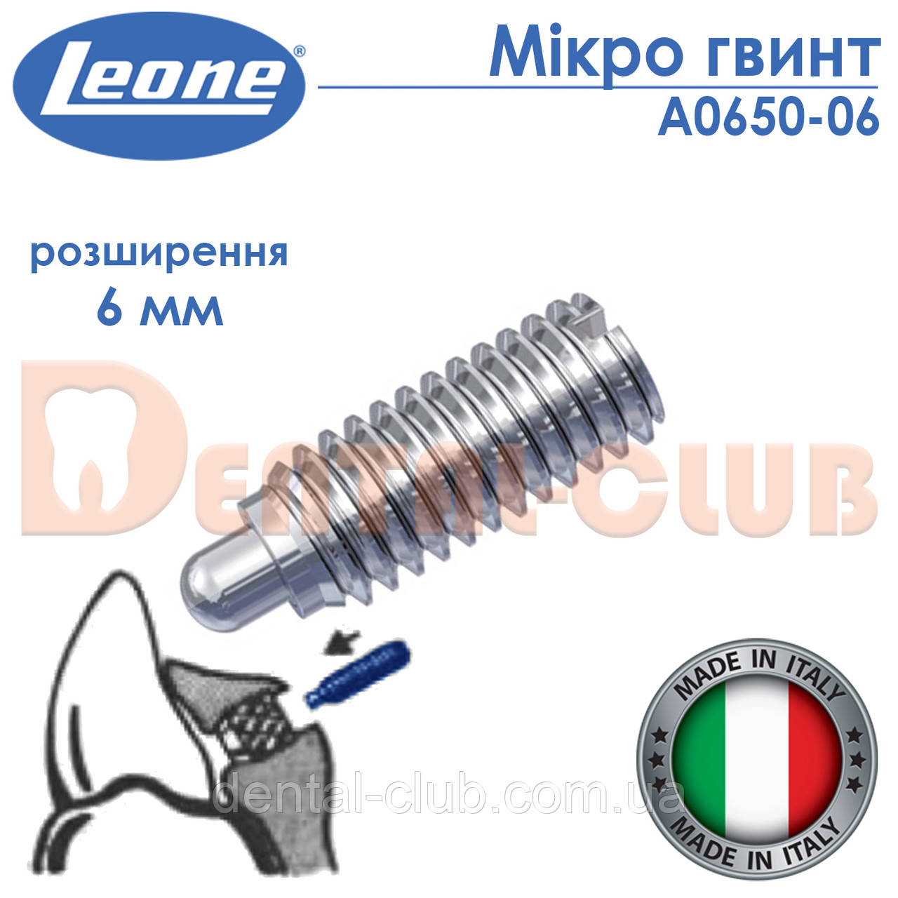 Мікро гвинт для переміщення одного зуба Leone (Леоне) А0650-06, фото 1