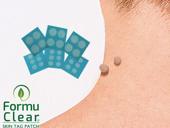 Пластырь Formu Clear от папиллом и бородавок, цена 261 грн — Prom.ua ...