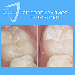 Як розвиваються герметики?