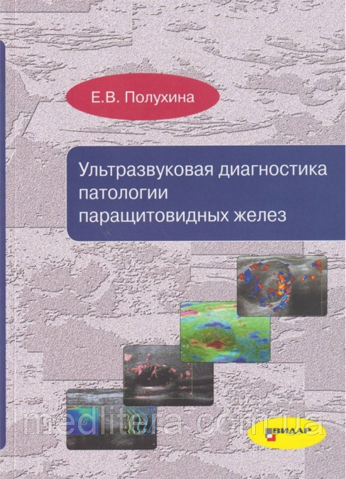 Полухін Е. В. Ультразвукова діагностика патології паращитовидних залоз