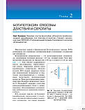 Коулман. Карпов. Застосування ботулотоксину в процедурах з омолодження обличчя, фото 8