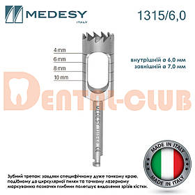 Трепан для кутового наконечника для кісткових блоків, діаметр 6,0 мм – 7,0 мм, Medesy 1315/6,0