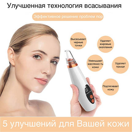 Вакуумный очиститель пор кожи лица белый Pore Cleaner 106598 прибор для пилинга и вакуумной чистки 6 насадок, фото 2