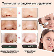 Вакуумный очиститель пор кожи лица белый Pore Cleaner 106598 прибор для пилинга и вакуумной чистки 6 насадок, фото 3