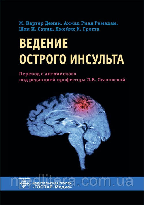 Ведення гострого інсульту/М. Картер Денні, Ахад Ріад Рамадан 2021 г