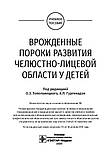 Вроджені вади розвитку щелепно-лицевої зони в дітей: навчальний посібник/підред. О. З. Топольницького, фото 2