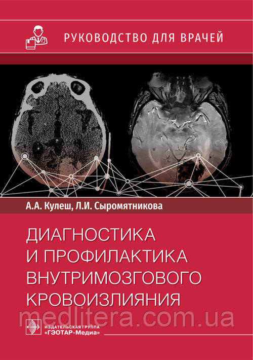 Діагностика та профілактика внутрішньомозкового крововиливу: посібник для лікарів/А. А. Кулеш