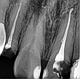 Портативний дентальний рентген апарат Vatech AnyRay II Оригінал для стоматології Південна Корея версія 2023, фото 9