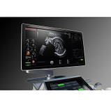 GE Voluson E8 стаціонарний УЗД апарат, фото 5