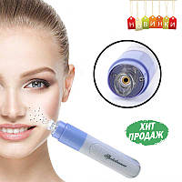 Вакуумный очиститель пор лица Spot Face Cleaner, Pore Cleaner прибор для чистки пор лица, Эксклюзивный