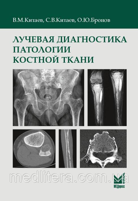 Київ В.М. Променева діагностика патології кісткової тканини 2022