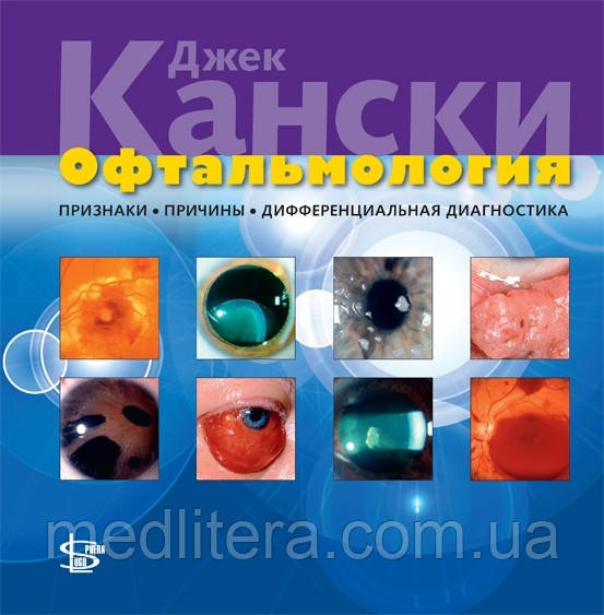 Канскі Дж. Офтальмологія: ознаки, причини, диференціальна діагностика 2012 рік