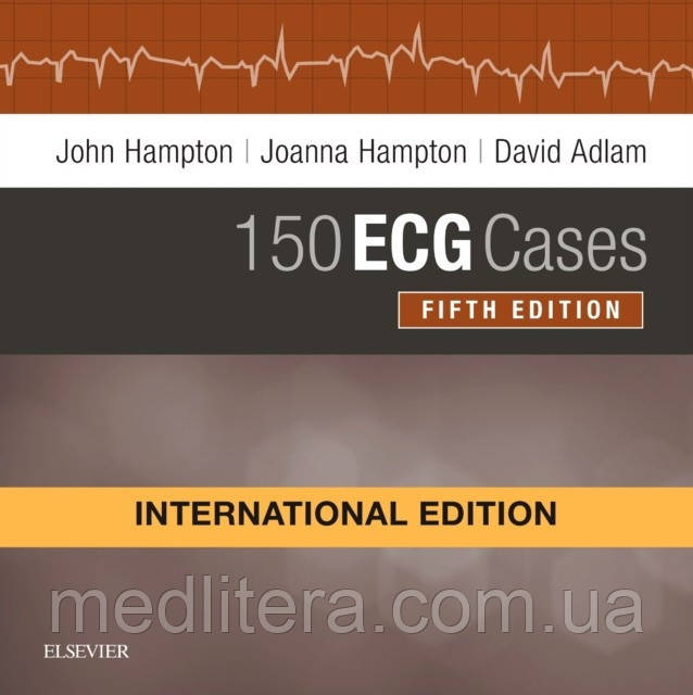 150 ECG Cases, International Edition, Hampton, John R 2019 рік