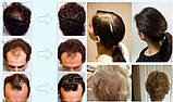 Оригінал! Лікувальна есенція, активатор і відновлення росту волосся "Andrea Hair Growth Essence" (20 мл)., фото 8