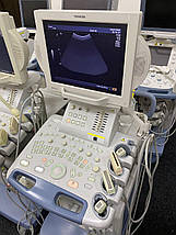 УЗД апарат TOSHIBA Nemio XG, фото 6