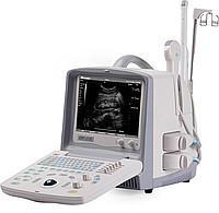 УЛЬТРАЗВУКОВИЙ СКАНЕР EMP 2100