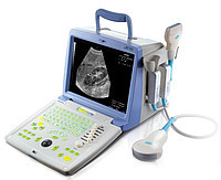 УЛЬТРАЗВУКОВИЙ ПОРТАТИВНИЙ СКАНИР EMP-830