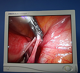 Система видеоэндоскопическая - Stryker 1288 HD Video System Endoscopy, фото 2