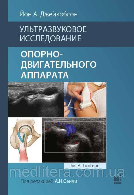 Йон А. Джейкобсон. Ультразвукове дослідження опорно-рухового апарату