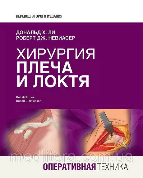 Дональд Г. Лі, Роберт Дж. Невіасер. Хірургія плеча і ліктя
Оперативна техніка