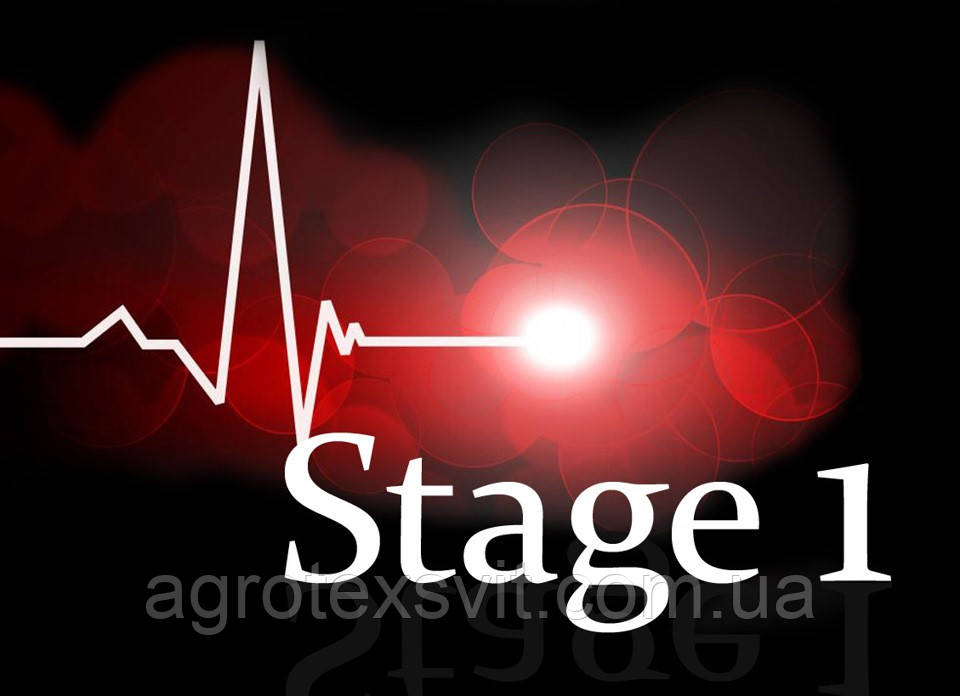 Stage 1, Чіп Тюнінг, Євро 2, Видалення каталізатора, Ремонт вихлопної системи, фото 1