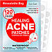 Гідроколоїдні точкові патчі від прищів LUA LUA Acne Pimple Patches 120 шт, фото 7