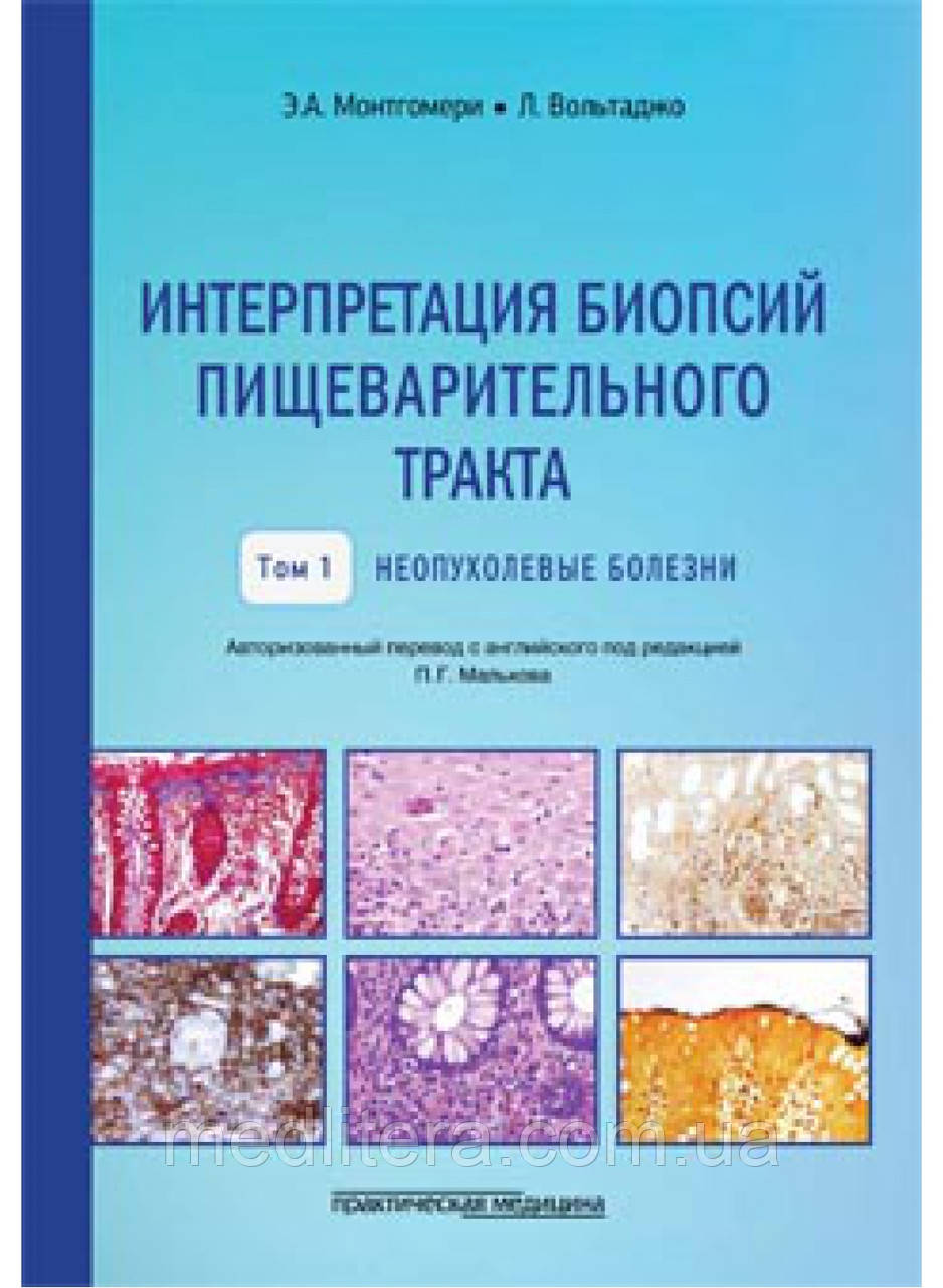 Монтгомері Е.А., Вольтаджо Інтерпретування біопсій травного тракту. Непухлинні хвороби. Том 1