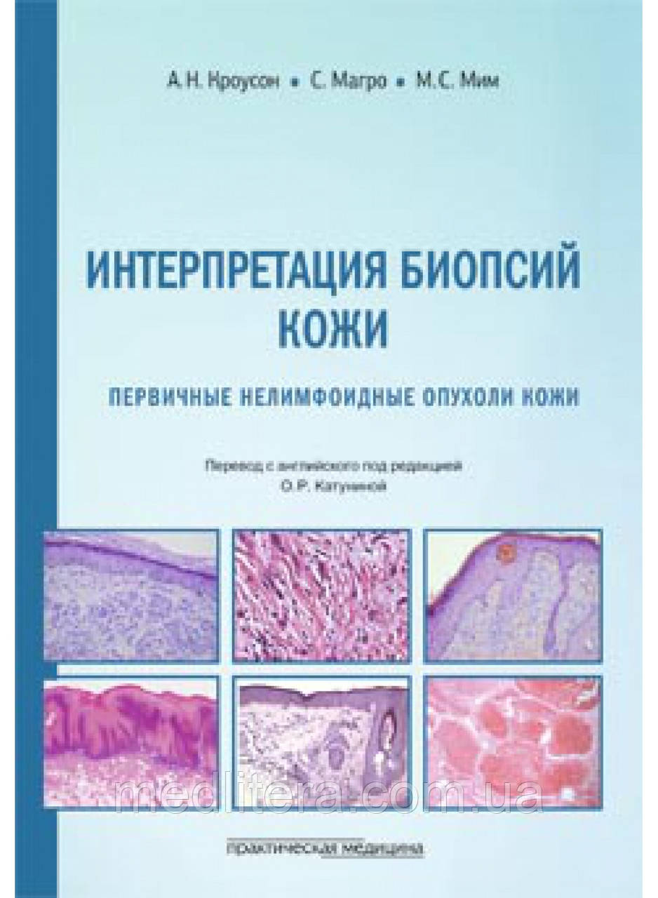 Кроусон. Інтерпретація біопсій шкіри. Первинні нелімфоїдні пухлини шкіри, фото 1
