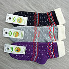 Шкарпетки дитячі махрові високі з відворотом для дівчинки орнамент eko 18р випадкове асорті 30033253, фото 2