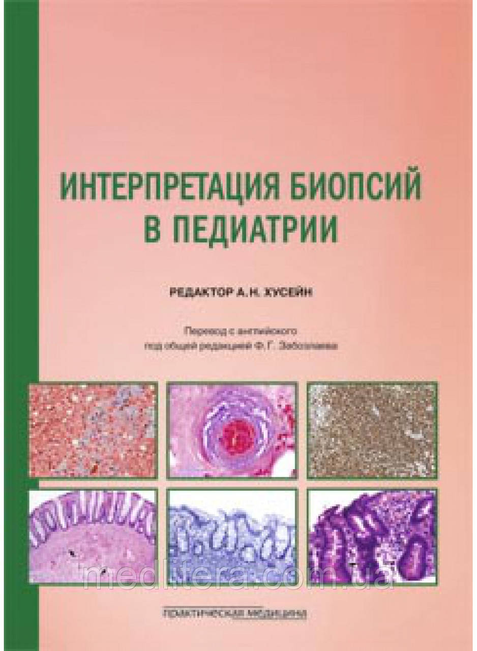 Хусейн. Інтерпретація біопсій у педіатрії, фото 1