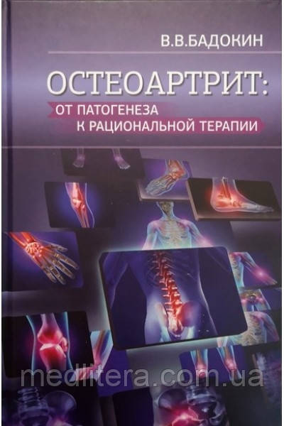 Остеоартрит: від патогенезу до раціональної терапії. Бадокін В.В.