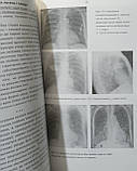 Прокопчук М. Протоколи рентгенологічних досліджень (зразки), фото 5