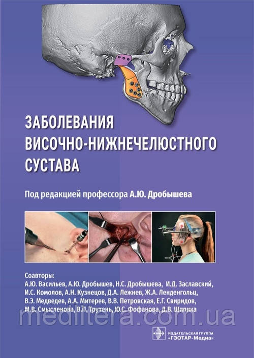 А.Ю. Дробішева Захворювання віско-нижково-незаймистного суглоба